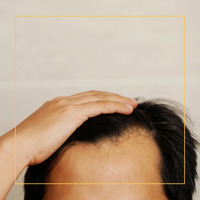 Hair Loss and Thinning Causes